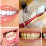Descubre el secreto para una sonrisa radiante: Cómo limpiar los dientes con aceite de coco y bicarbonato
